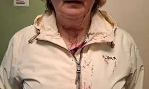 После избиения мигрантами экс-следователя в Красном Селе возбуждено уголовное дело. СК проверяет работу полиции После избиения мигрантами экс-следователя в Красном Селе возбуждено уголовное дело. СК проверяет работу полиции