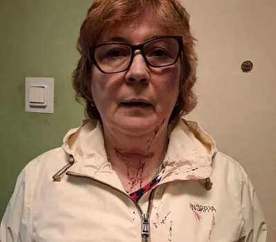 после избиения мигрантами экс-следователя в красном селе возбуждено уголовное дело - Сайт Газеты «Совершенно Секретно» после избиения мигрантами экс-следователя в красном селе возбуждено уголовное дело - Сайт Газеты «Совершенно Секретно»