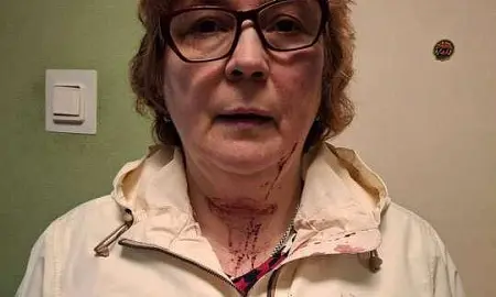 После избиения мигрантами экс-следователя в Красном Селе возбуждено уголовное дело. СК проверяет работу полиции После избиения мигрантами экс-следователя в Красном Селе возбуждено уголовное дело. СК проверяет работу полиции