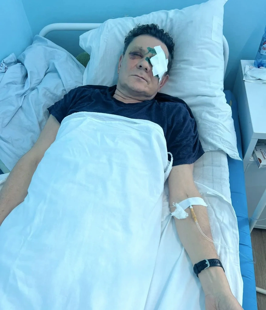 избитыи 8.webp избитыи 8.webp