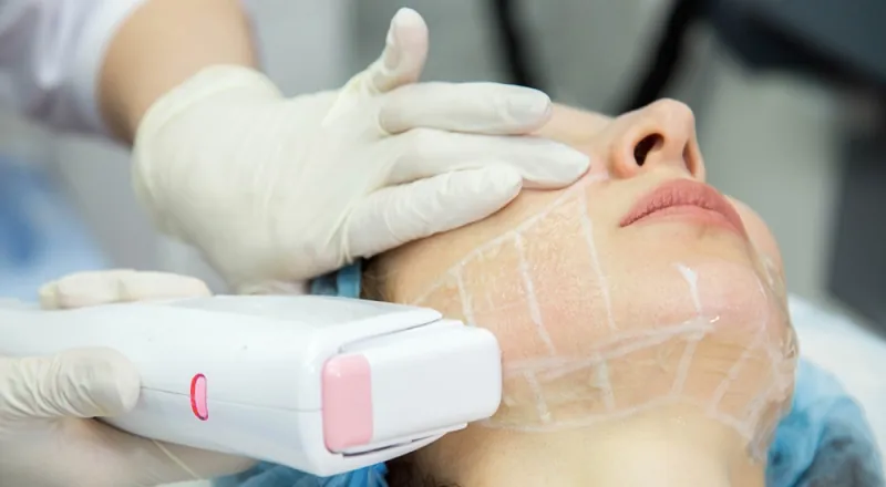 liftingg.webp SMAS-лифтинг лица