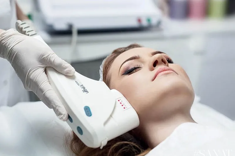 lifting.webp Ультразвуковой SMAS-лифтинг