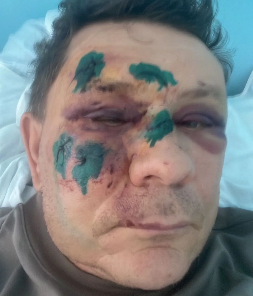 избитыи 7.webp избитыи 7.webp