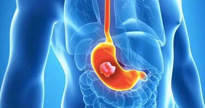 atroficheskiy_gastrit.webp atroficheskiy_gastrit.webp