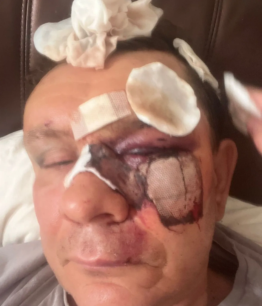 избитыи 4.webp избитыи 4.webp