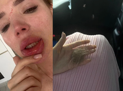 беременную избили в лифте элитного жк в подмосковье  - Сайт Газеты «Совершенно Секретно»