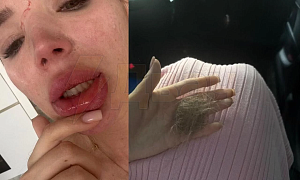 Беременную избили в лифте элитного ЖК в Подмосковье 